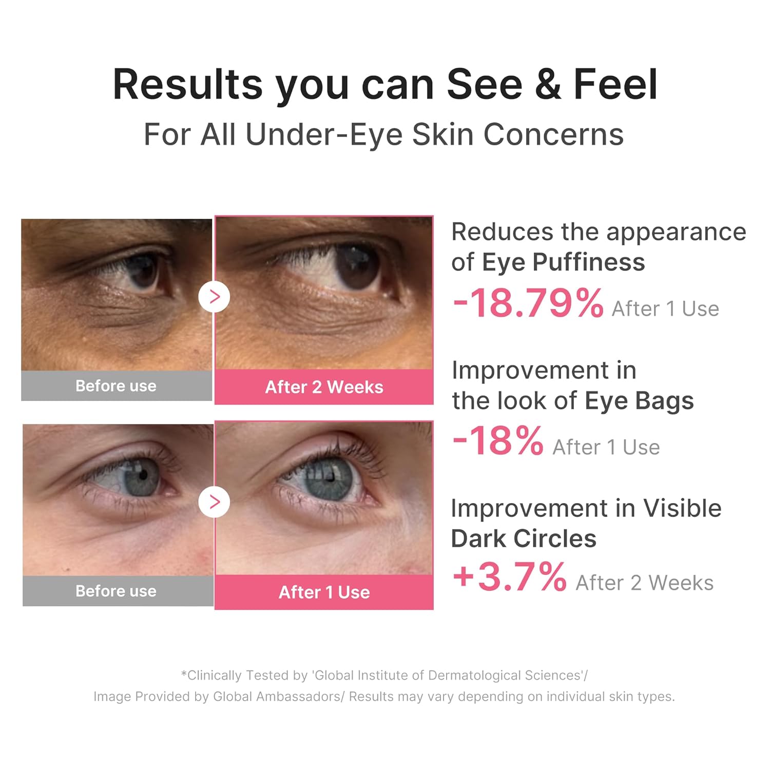 medicube Ultimate Night Eye Routine Duo: PDRN Caffeine Collagen Eye Patches and Salmon DNA PDRN Eye Cream | For Appearance of Dark Circles, Undereye Bags, Firming Care | Korean Skincare